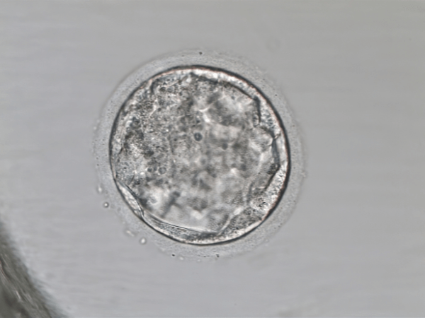 What is a blastocyst