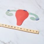 Endometriosis & Fertility